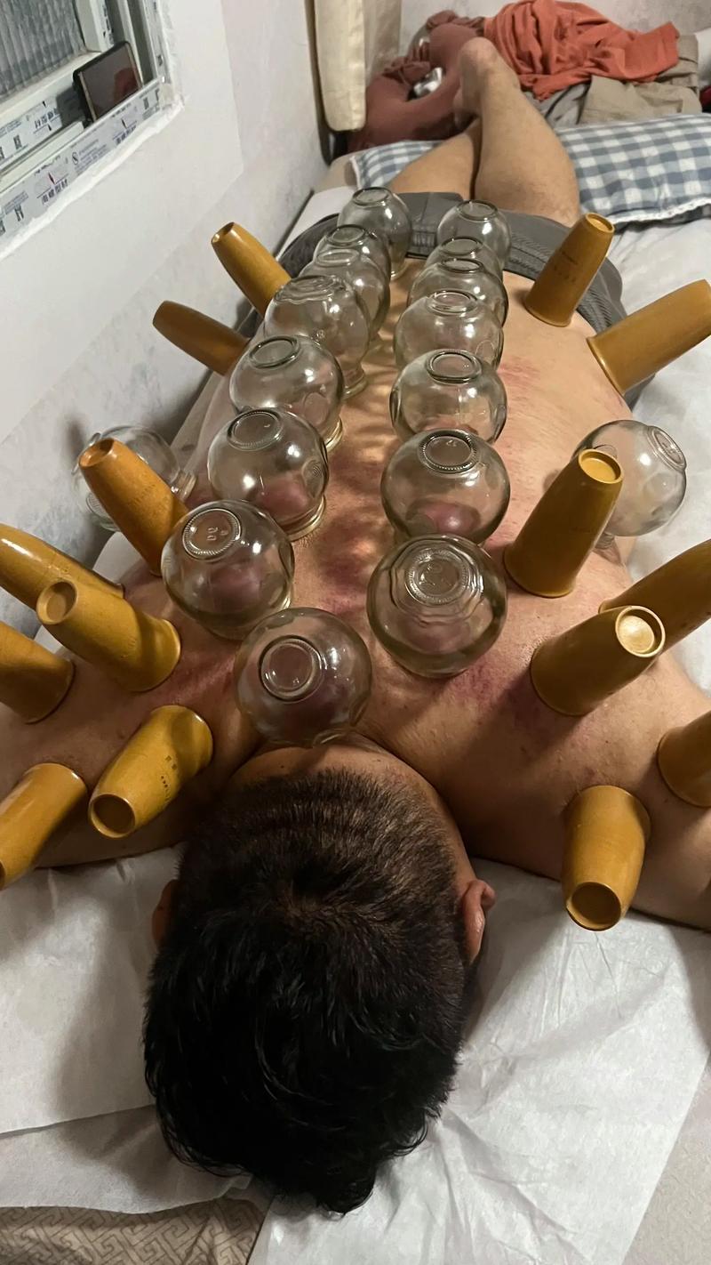 中医养生：现代生活的智慧选择